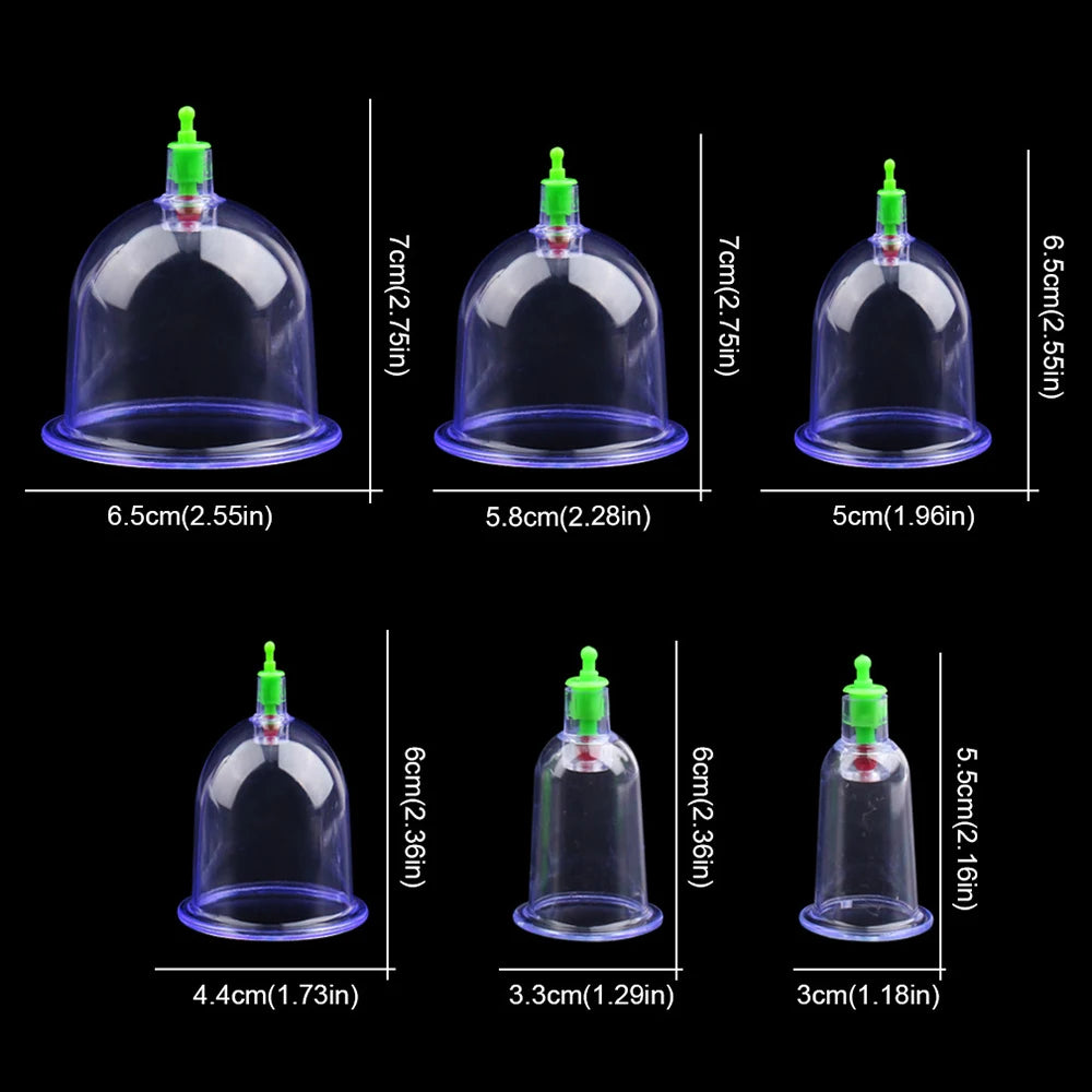 Cupping Set (6/12pc)