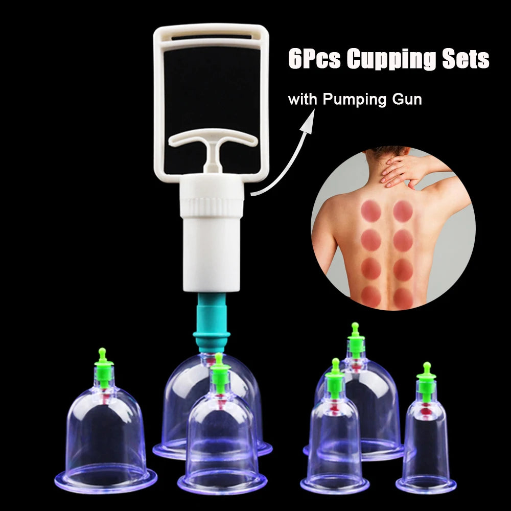 Cupping Set (6/12pc)