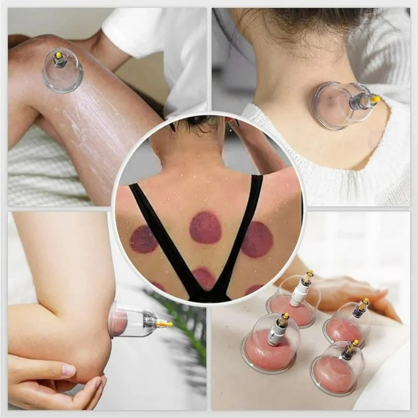 Cupping Set (12/22pc)