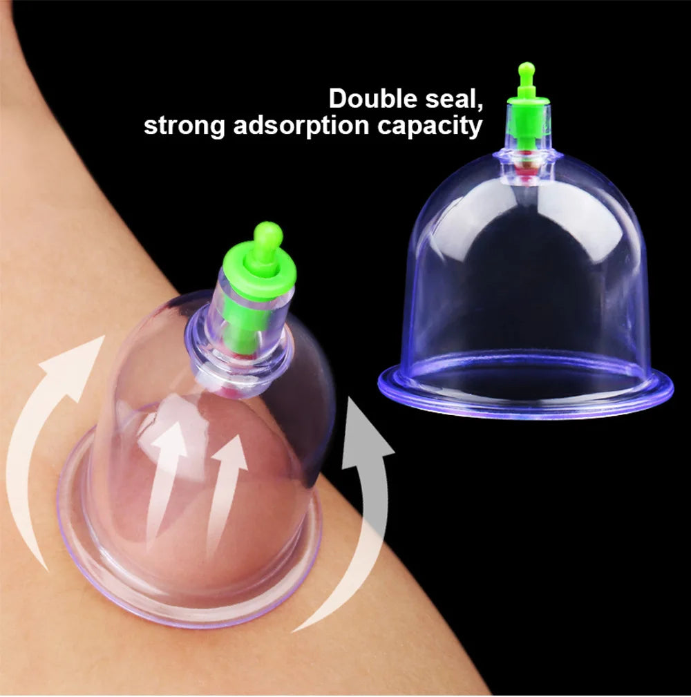 Cupping Set (6/12pc)